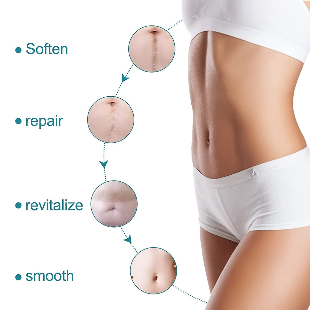 Scar Therapy Silicone Patch