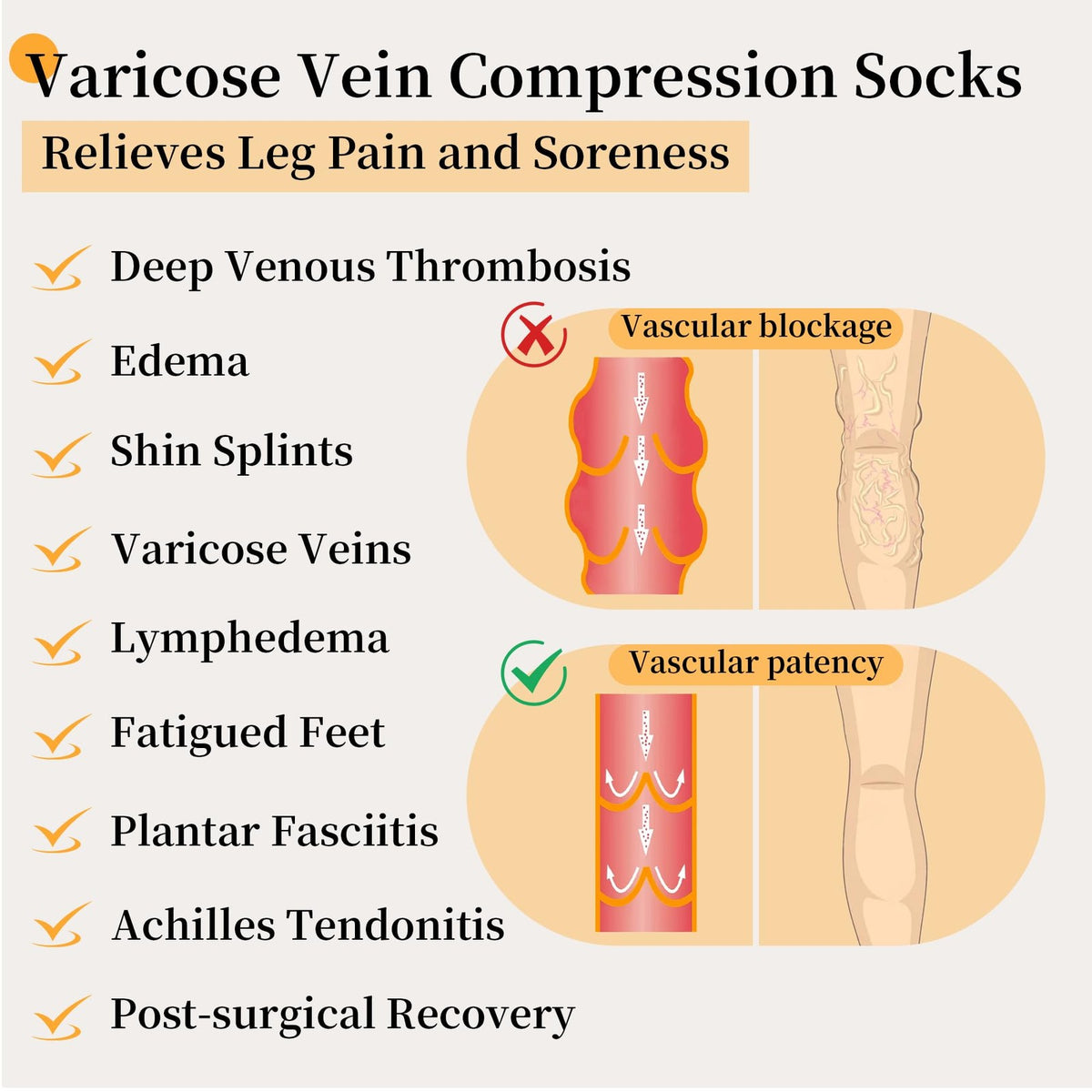 20-30Mmhg Thigh High Compression Socks, Compression Stockings