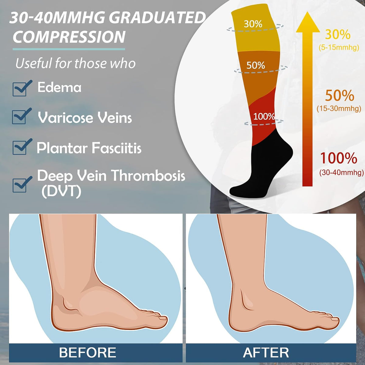 Medical Graduated 30-40Mmhg Compression Socks for Women&Men Circulation Knee High Socks Hiking Running Stockings